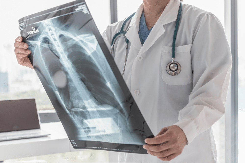 doctor holding x-rays